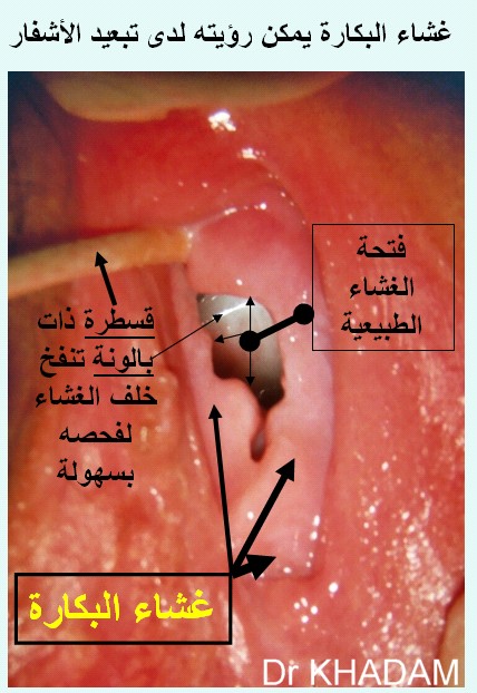 و بالصورة التالية شكل آخر 